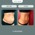 Cryo Body Contouring Certificate from Hair Gallery